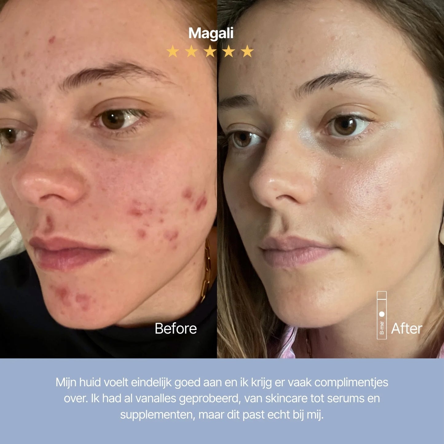 Clear skin