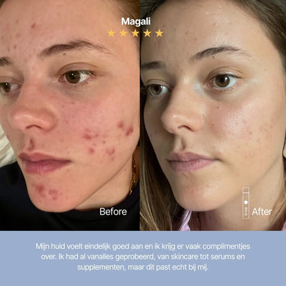 Clear skin